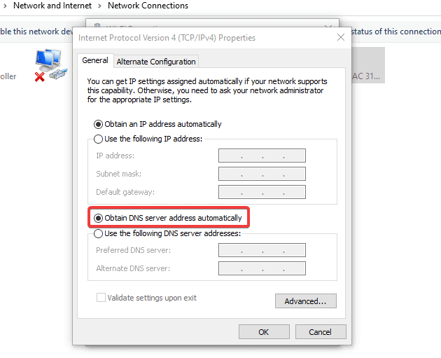 Aktivieren Sie DNS automatisch beziehen