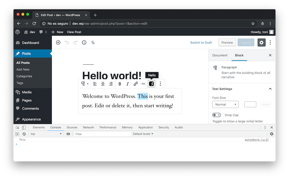 Si todo salió bien, aparecerá el nuevo botón en los bloques de texto.