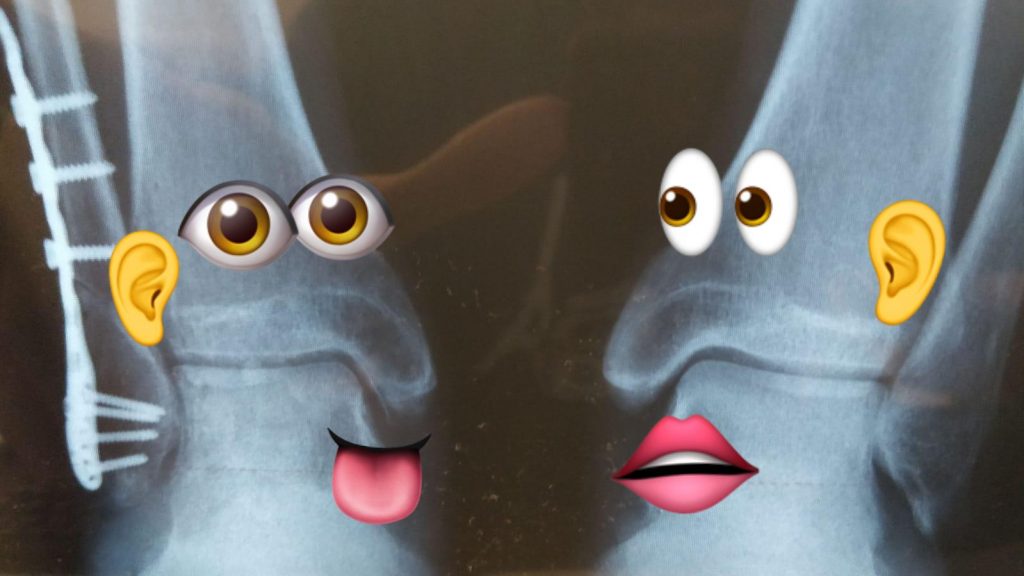 Тони интерпретация рентгена